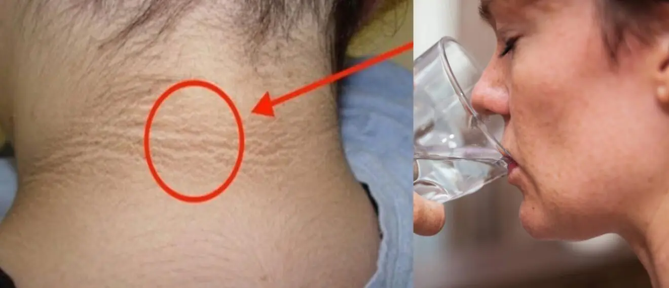 Nu ignora aceste semne timpurii ale diabetului