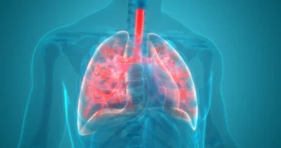 Creștere alarmantă a cazurilor de pneumonie în România! Copiii și vârstnicii, cei mai afectați
