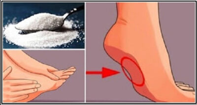 Atenție! 14 simptome care îți arată că ai glicemia ridicată și nu trebuie ignorate!