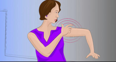 Alertă de sănătate! 12 simptome care pot anunța un accident vascular cerebral – ce trebuie să faci imediat dacă le observi!