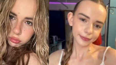 Cutremurător! O tânără de 15 ani a aflat că are cancer osos în stadiul 4 după o banală căzătură cu bicicleta!