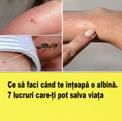 Atenție! Remedii simple care te scapă rapid de durerile și umflăturile după înțepăturile de viespe și albine!