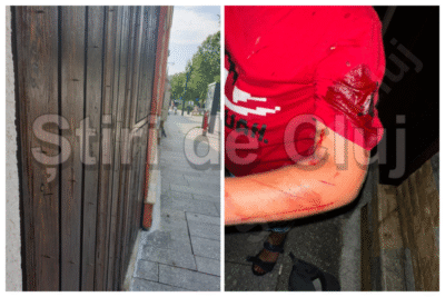 Copil rănit grav la Cluj după ce a căzut pe un gard cu cuie ascuțite – anchetă în curs