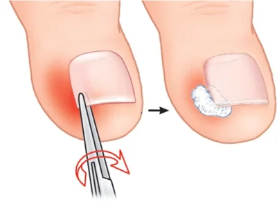 Descoperă cele 8 remedii naturiste care îți vor transforma unghiile încărcate în doar câteva săptămâni!