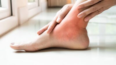 Nu tot magneziul te scapă de cârcei. Pe care trebuie să-l alegi pentru a vedea rezultate rapide