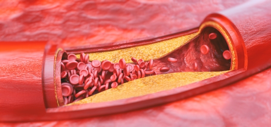 Arterelor