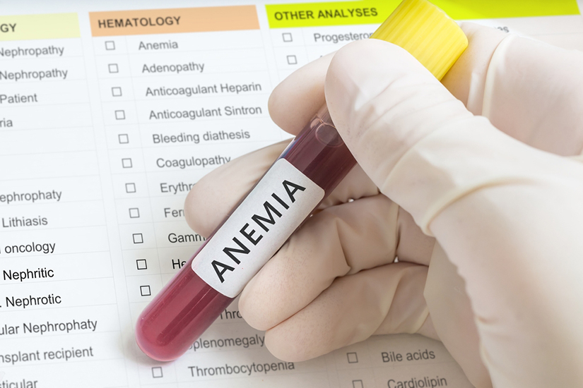 anemiei