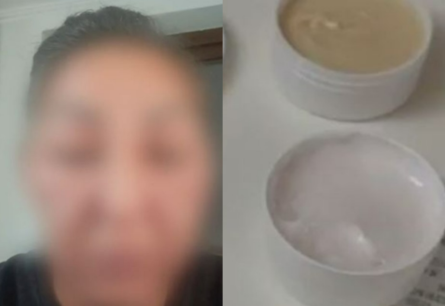 O femeie a ajuns in stare grava la spital